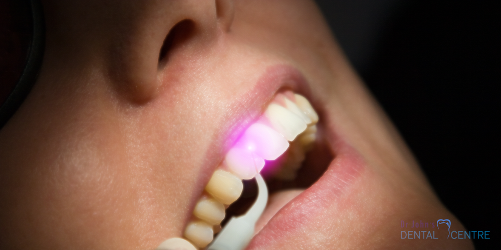 Lasers at Dr John's Dental Centre, Trivandrum