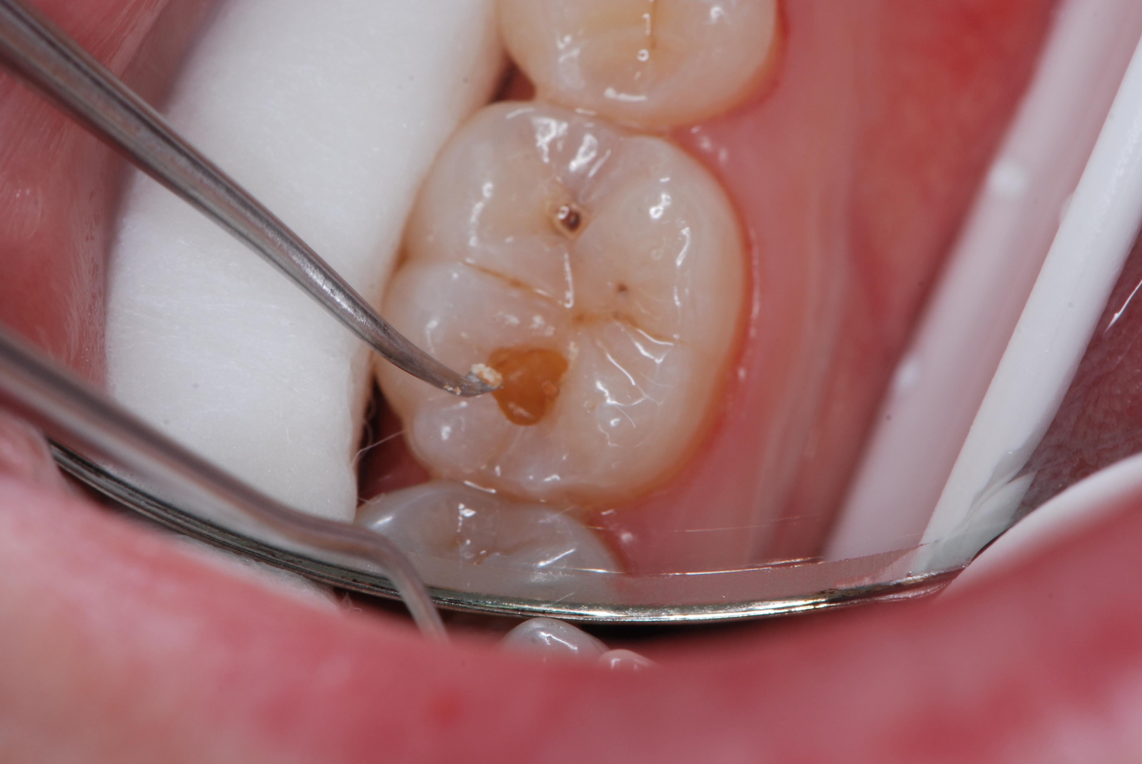 Biomimetic Dentistry at Dr John's Dental Centre