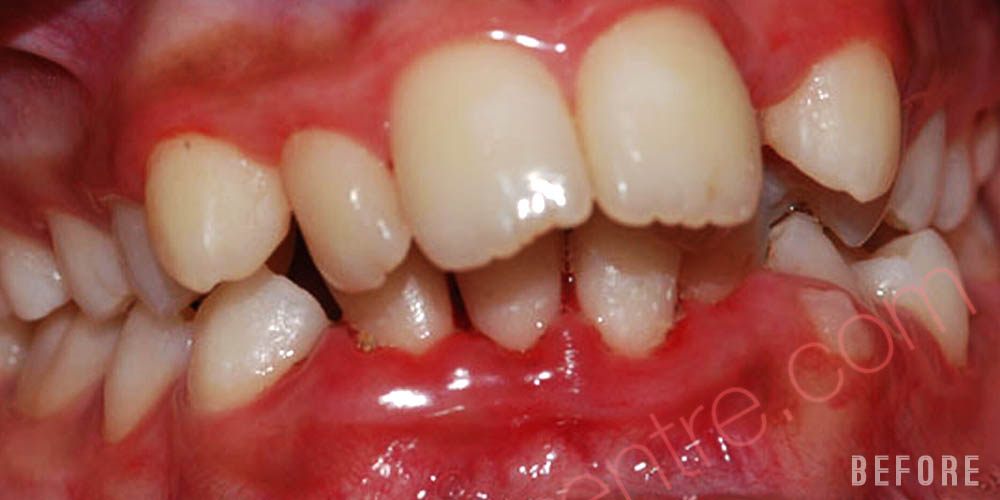 Dr-Johns-Dentistry-Services-Smile-correction